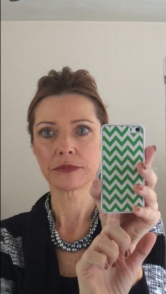 Quyết định căng da mặt sau một năm đắn đo