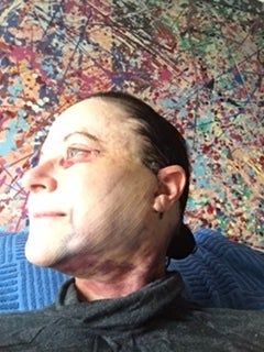 Căng da mặt với mức giá hợp lý