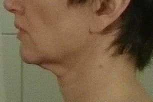 46 tuổi và đã sẵn sàng căng da mặt