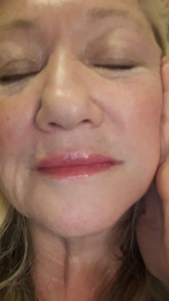 Căng da mặt ở tuổi 64