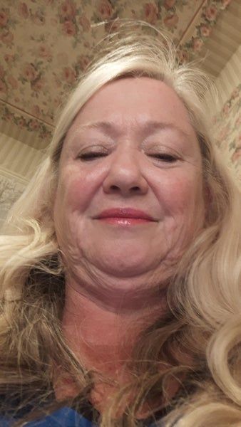 Căng da mặt ở tuổi 64