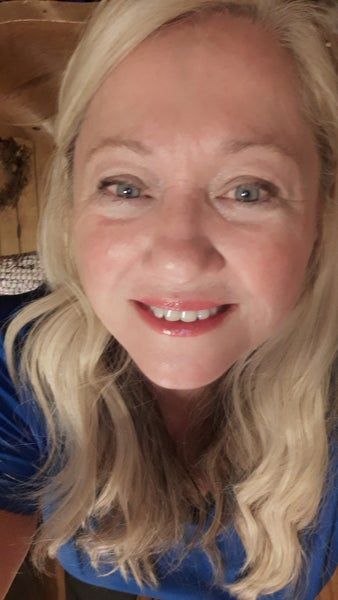 Căng da mặt ở tuổi 64