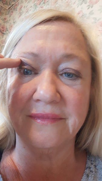 Căng da mặt ở tuổi 64