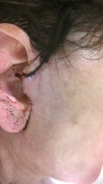 46 tuổi và đã sẵn sàng căng da mặt