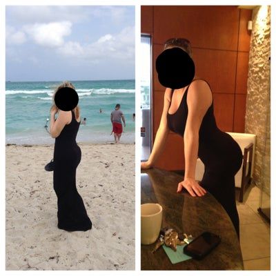 “Anh ấy đã tạo ra một KIỆT TÁC từ cơ thể xấu xí trước đó của tôi” – Chia sẻ của bà mẹ 29 tuổi sau khi cấy mỡ tự thân vùng mông