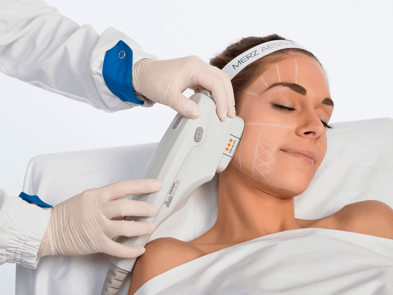 ultherapy suckhoe123