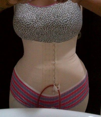 Hành trình cấy mỡ tự thân vùng mông của bà mẹ 3 con, 30 tuổi