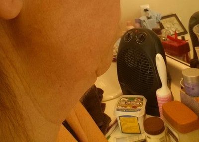 Kết quả hài lòng sau khi căng da cổ và căng da vùng mặt dưới ở tuổi 48