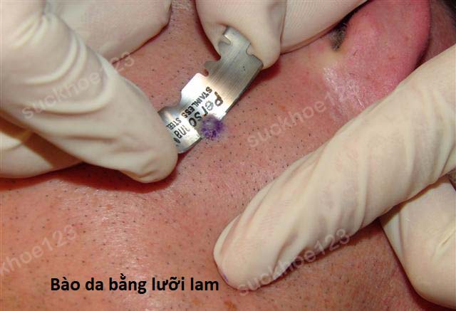 cao not ruoi bang dao lam