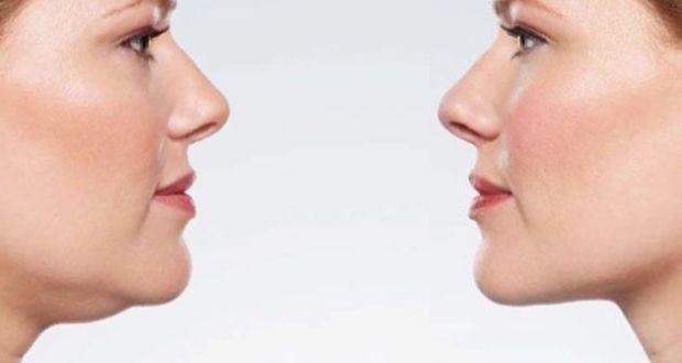 how to get rid of double chin