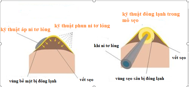 ni tơ