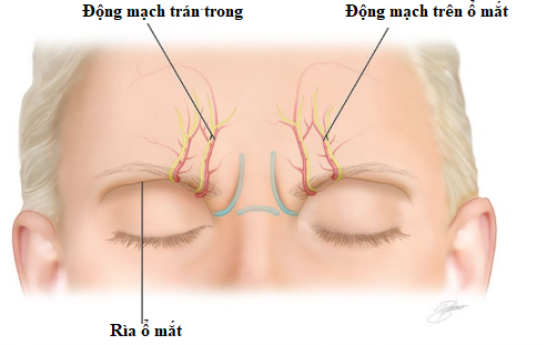 tiêm filler