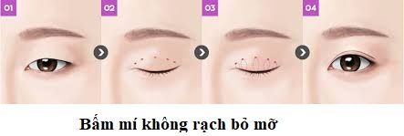 bấm mí 2