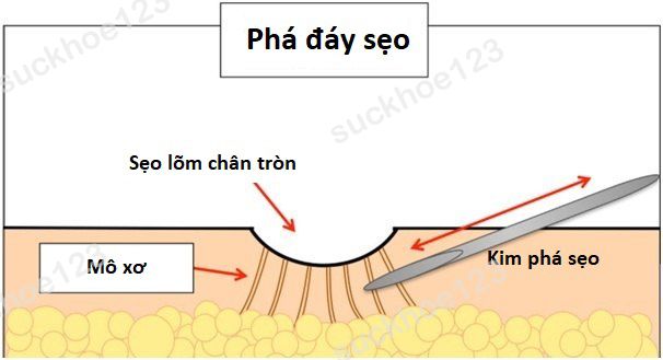 pha day seo