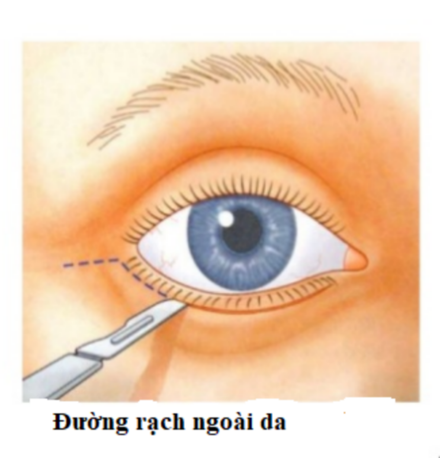 cat mi duoi 3