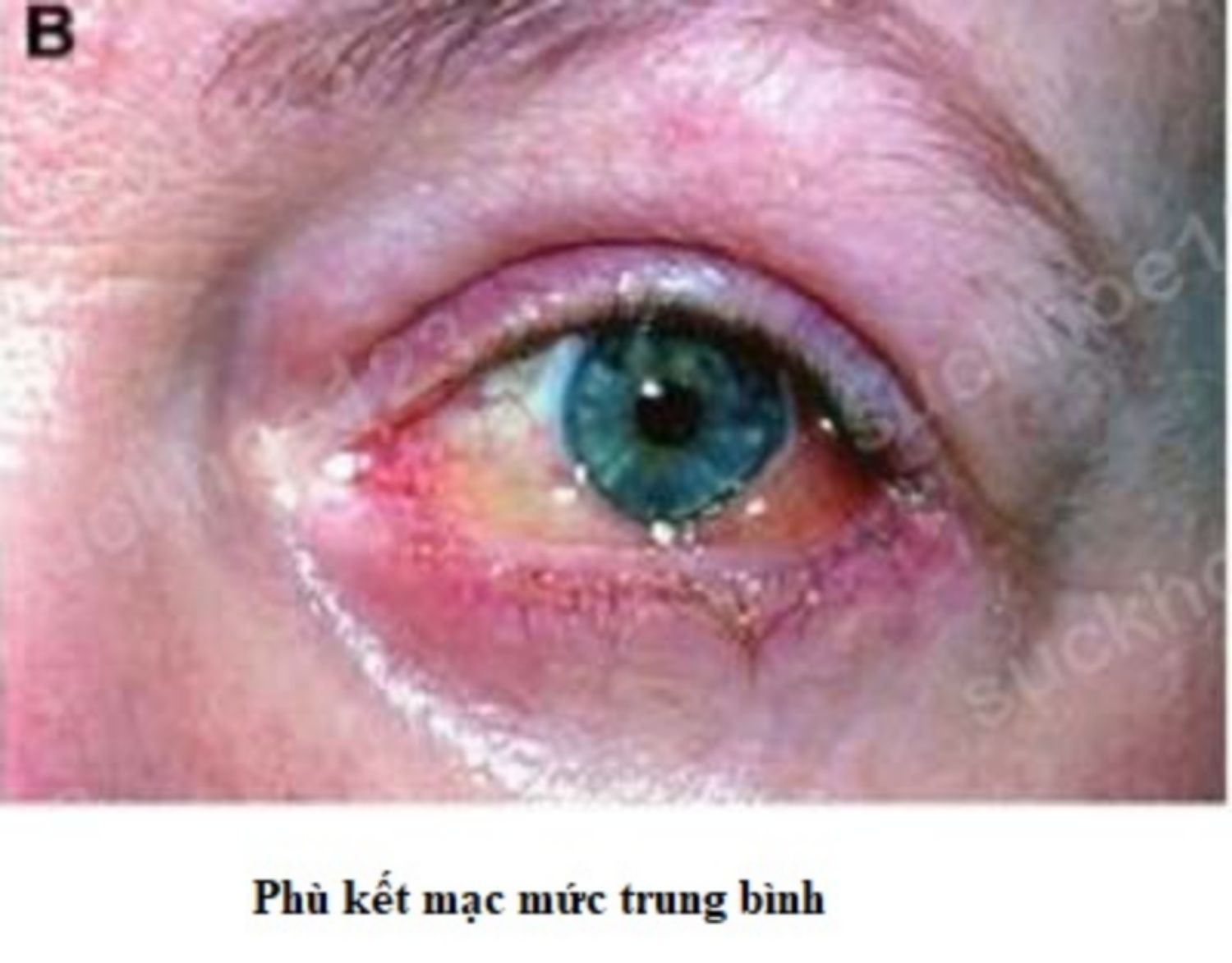 phu ket mac muc vua