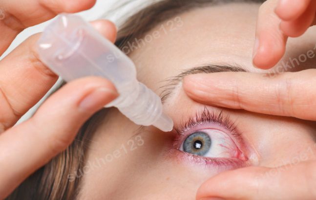 viêm giác mạc nhỏ thuoc măt