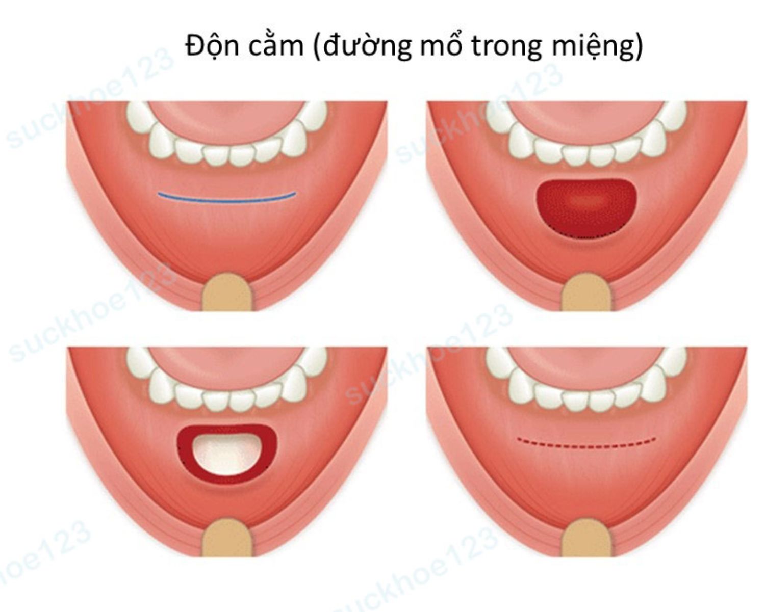 Slide2