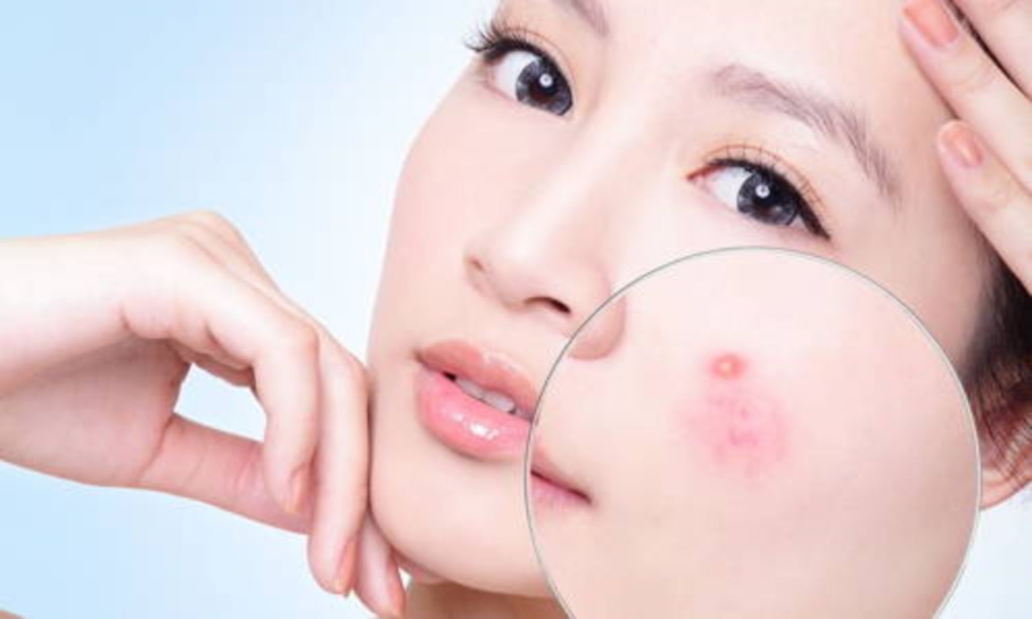 Tìm hiểu về kem dưỡng ẩm không chứa dầu oil-free, không gây mụn