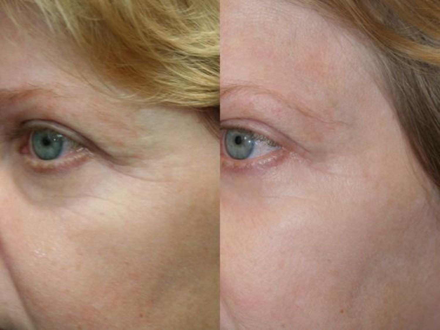 502