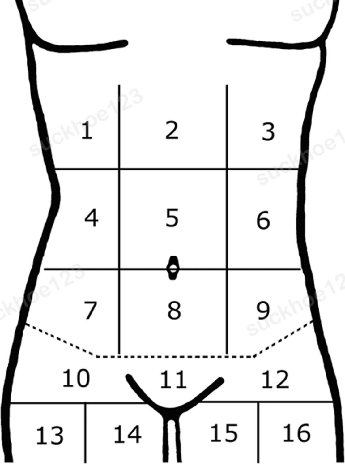 gox 3 e561 g002