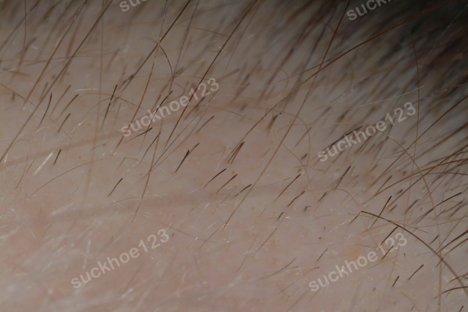 ch717 fig2