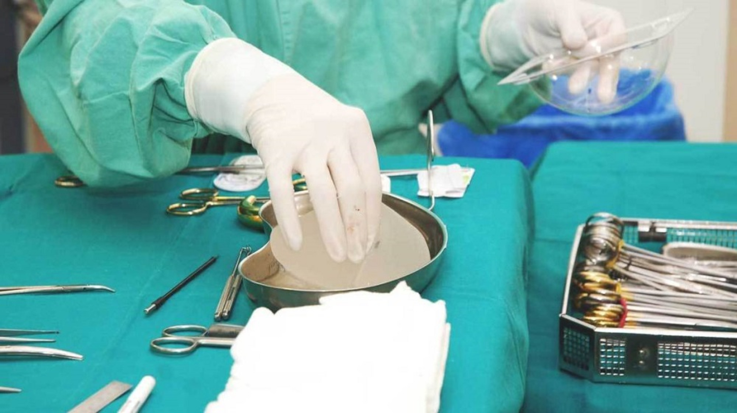 nâng ngực bằng túi độn 1