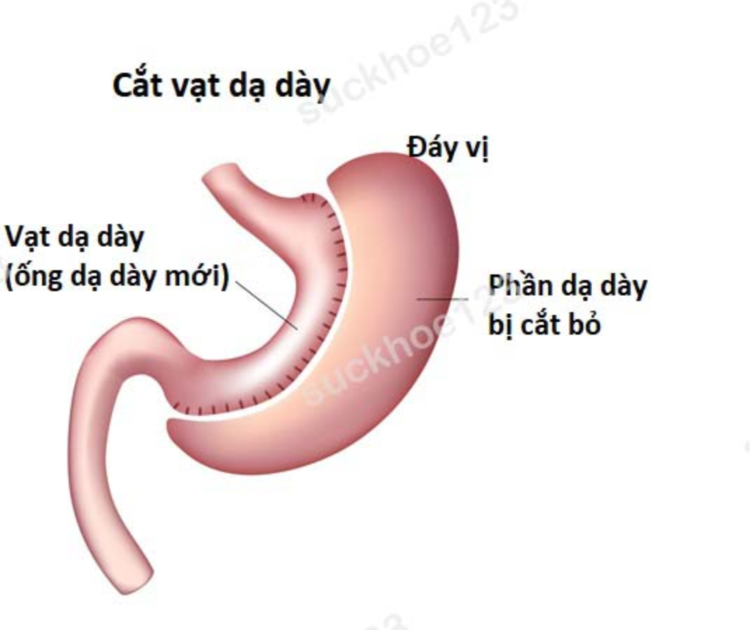 cat vat da day