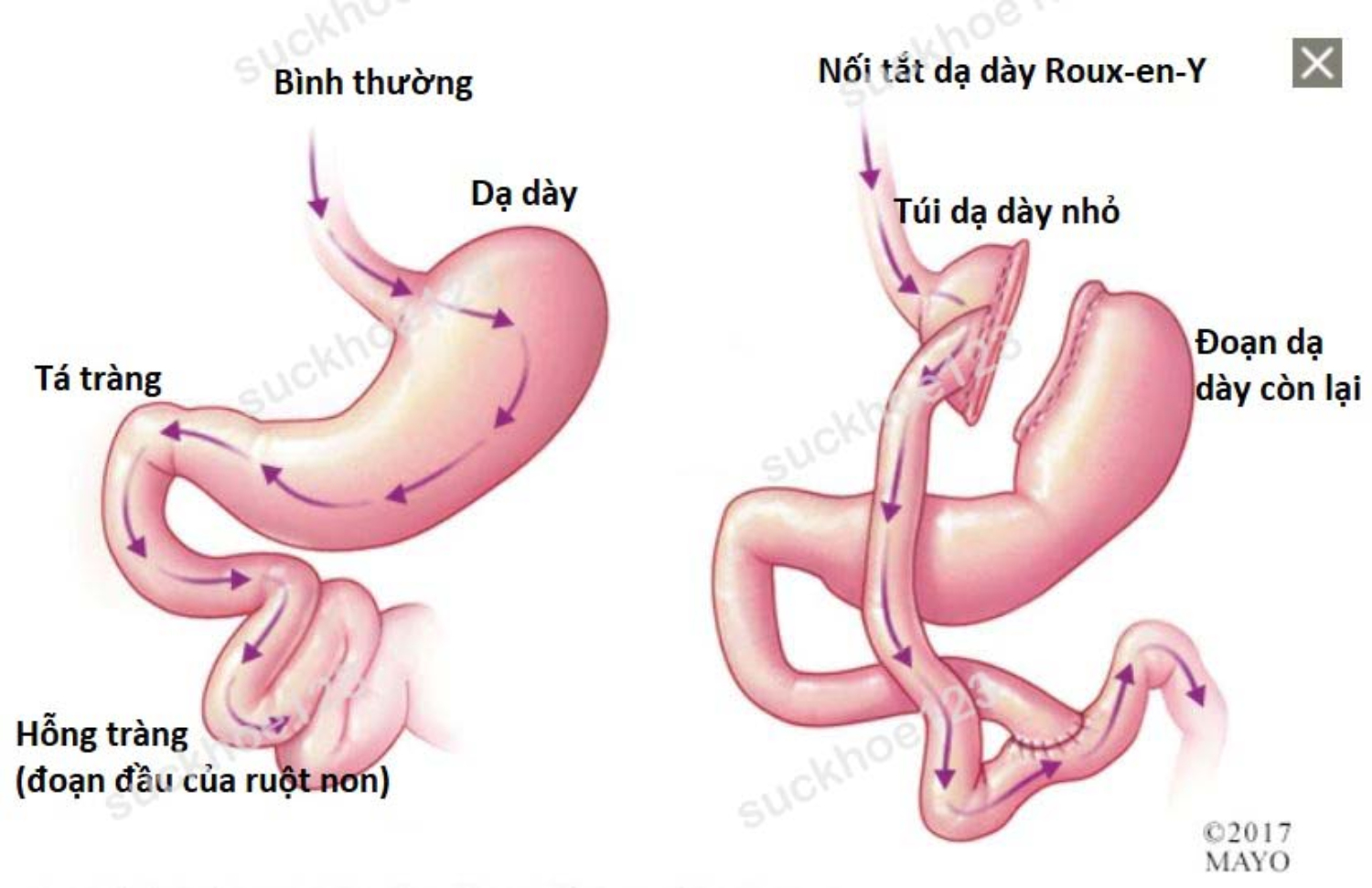 noi tat da day