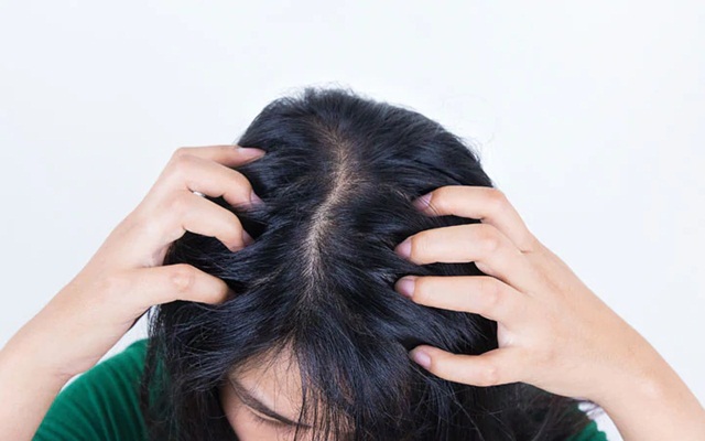 Đầu Nhanh Hôi: Nguyên Nhân Và Cách Điều Trị