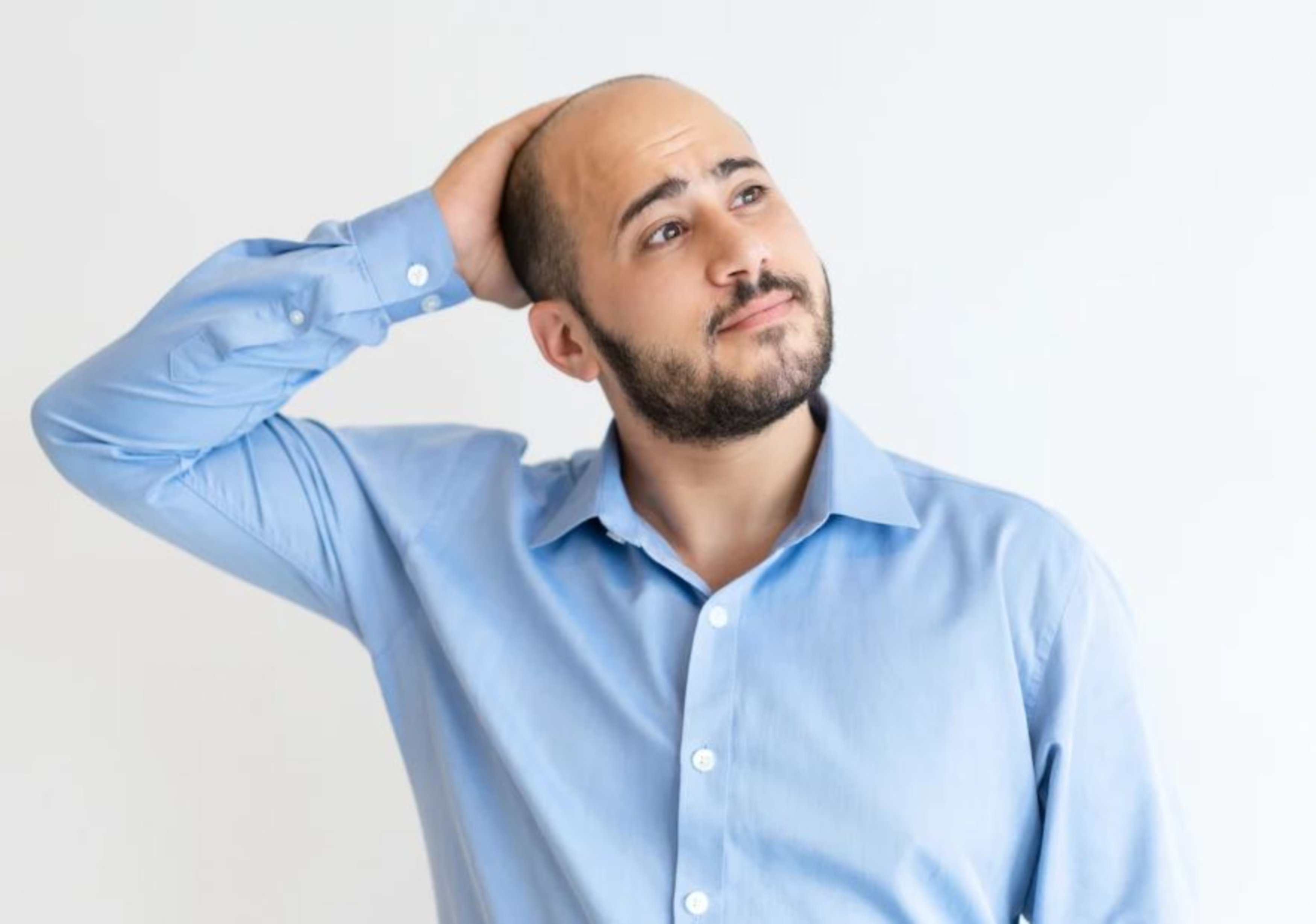 Hói đầu do di truyền có thể khắc phục! Cách điều trị tóc mỏng, hói đầu do di truyền