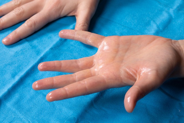 Điều trị tăng tiết mồ hôi bằng cách nào?