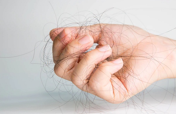 Tóc Rụng Thế Nào Là Bình Thường? Thế Nào Là Bất Thường?