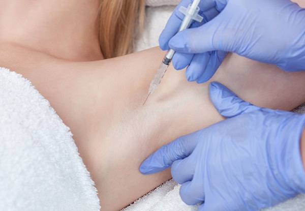 Tiêm Botox trị tăng tiết mồ hôi có hiệu quả không?