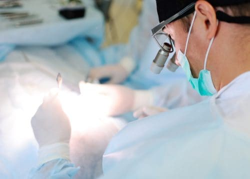 Triệt tuyến hôi nách vi phẫu là gì? Kết quả có vĩnh viễn không? Giá bao nhiêu?