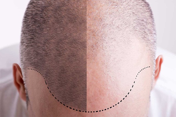 Xăm Chân Tóc Bền Được Bao Lâu?