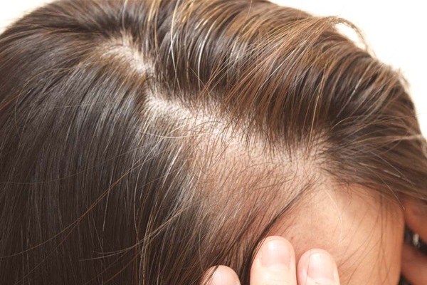 Làm Sao Để Tóc Dày Và Trở Nên Bồng Bềnh Hơn