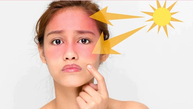 Retinol Có Khiến Da Nhạy Cảm Với Ánh Nắng Mặt Trời Không?