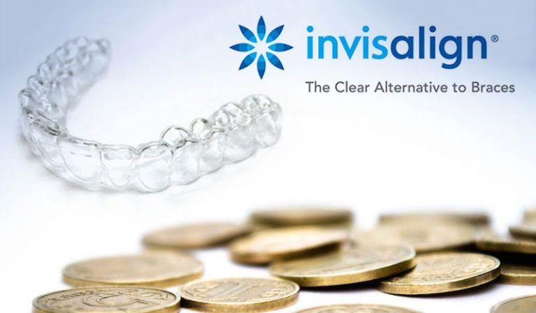 4 sai lầm phổ biến khi bắt đầu niềng răng trong suốt invisalign