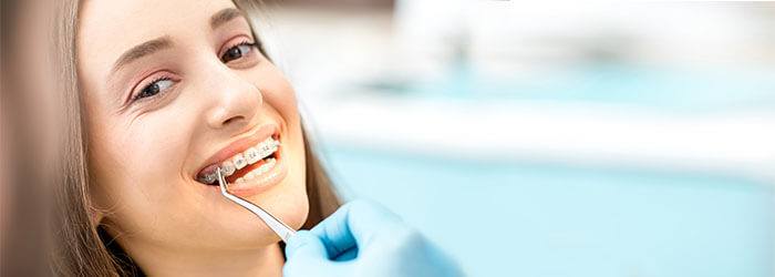 5 điều cần tránh khi niềng răng