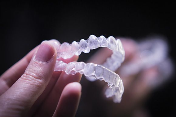 5 lợi ích của niềng răng trong suốt invisalign