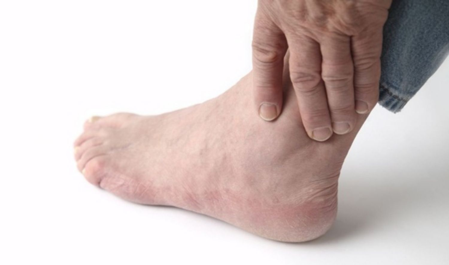 6 dấu hiệu tiềm ẩn của bệnh tĩnh mạch