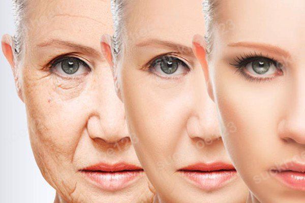 Xóa rãnh lệ - giải pháp hoàn hảo trả lại đôi mắt thanh xuân