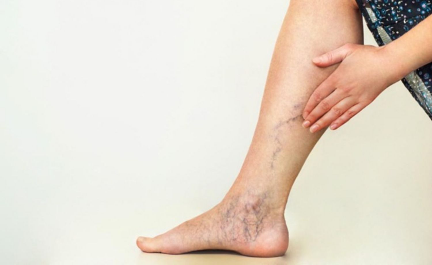 Các bệnh về tĩnh mạch và cách điều trị