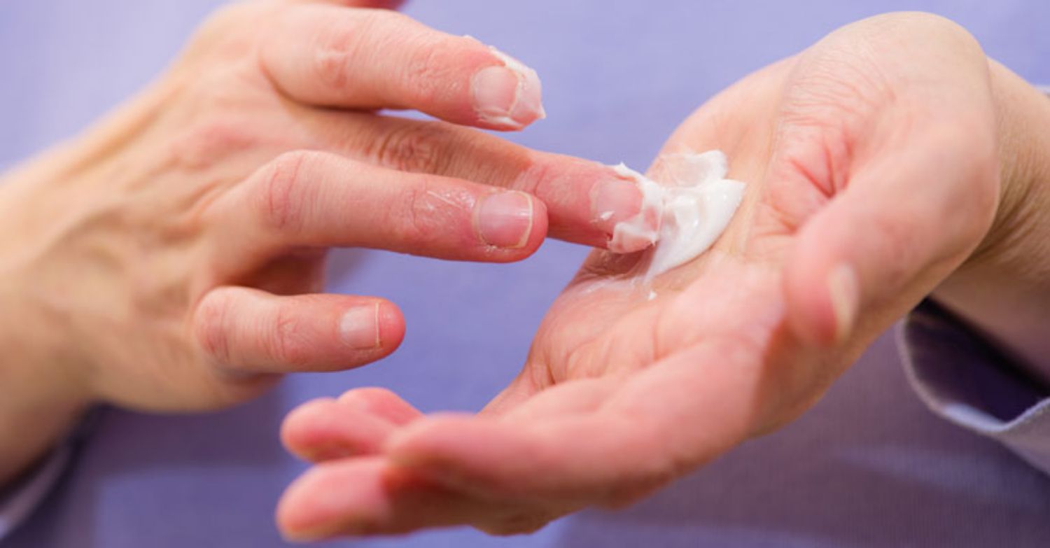 Cách chọn loại kem trị mụn hiệu quả
