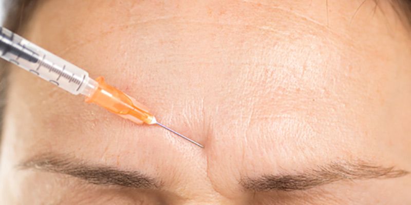 Các câu hỏi thường gặp về tiêm Botox