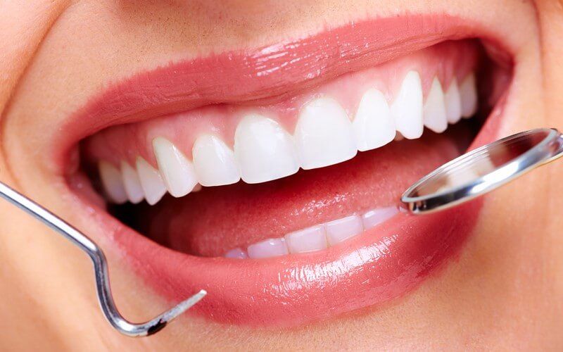 Có cần nhổ răng khi niềng răng không?