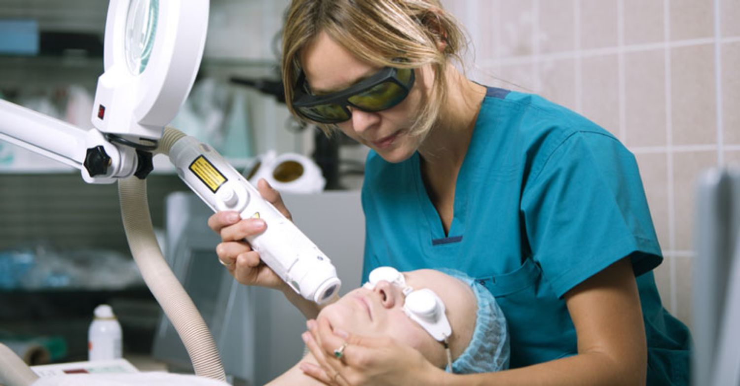 Có nên trị sẹo mụn bằng laser?