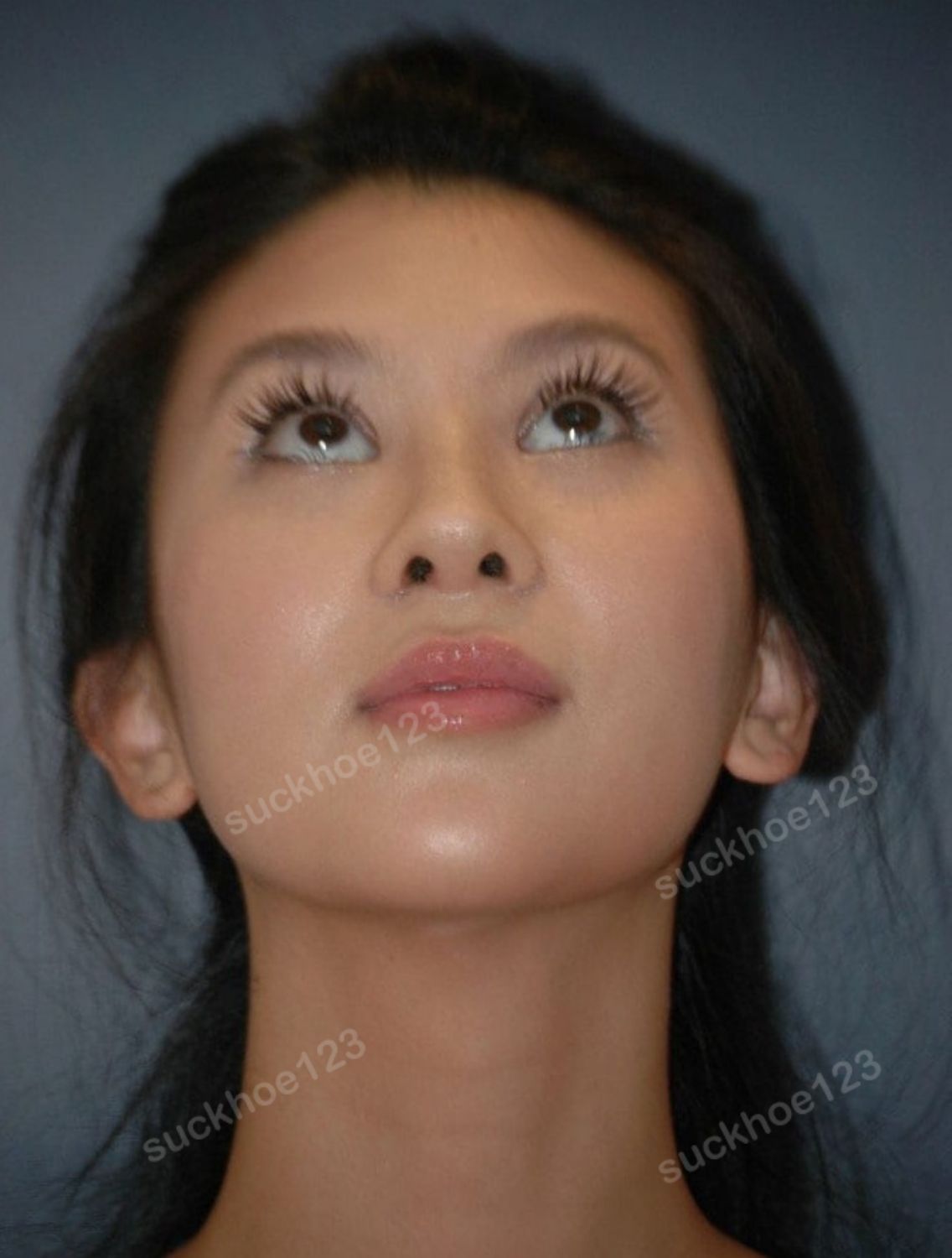 Khắc Phục Tình Trạng Lỗ Mũi Bên To Bên Nhỏ