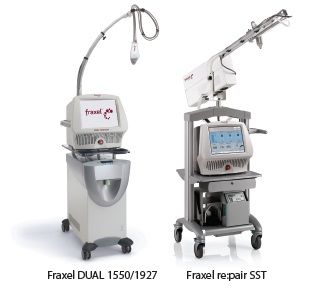 Laser Fraxel